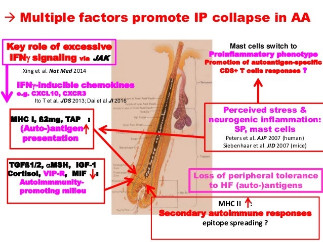 alopecia areata inflammation